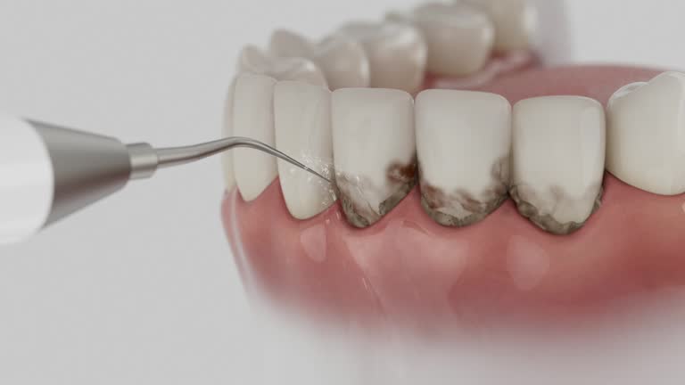 Reliable Dental Implants contractor in Ingalls, IN by Smile Center Dentistry